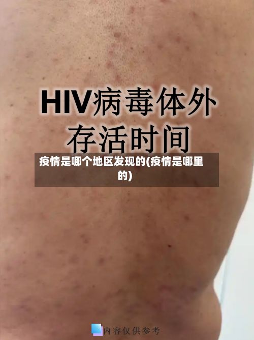 疫情是哪个地区发现的(疫情是哪里的)-第2张图片