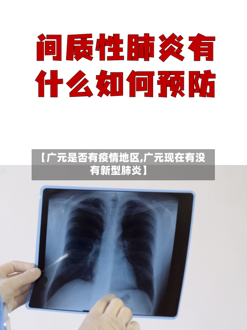 【广元是否有疫情地区,广元现在有没有新型肺炎】-第1张图片